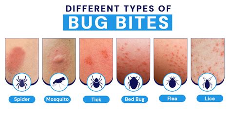 bitten animal bite center photos|19 Pictures of Common Bug Bites and Symptoms to Look For .